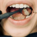 Este gadget me ha salvado de volver al dentista (¡y hasta de las arañas!) 🕷️🦷