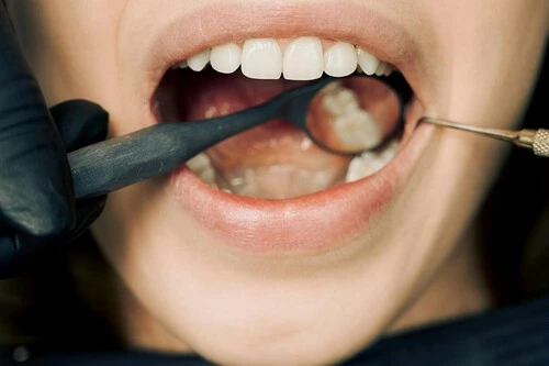 Este gadget me ha salvado de volver al dentista (¡y hasta de las arañas!) 🕷️🦷